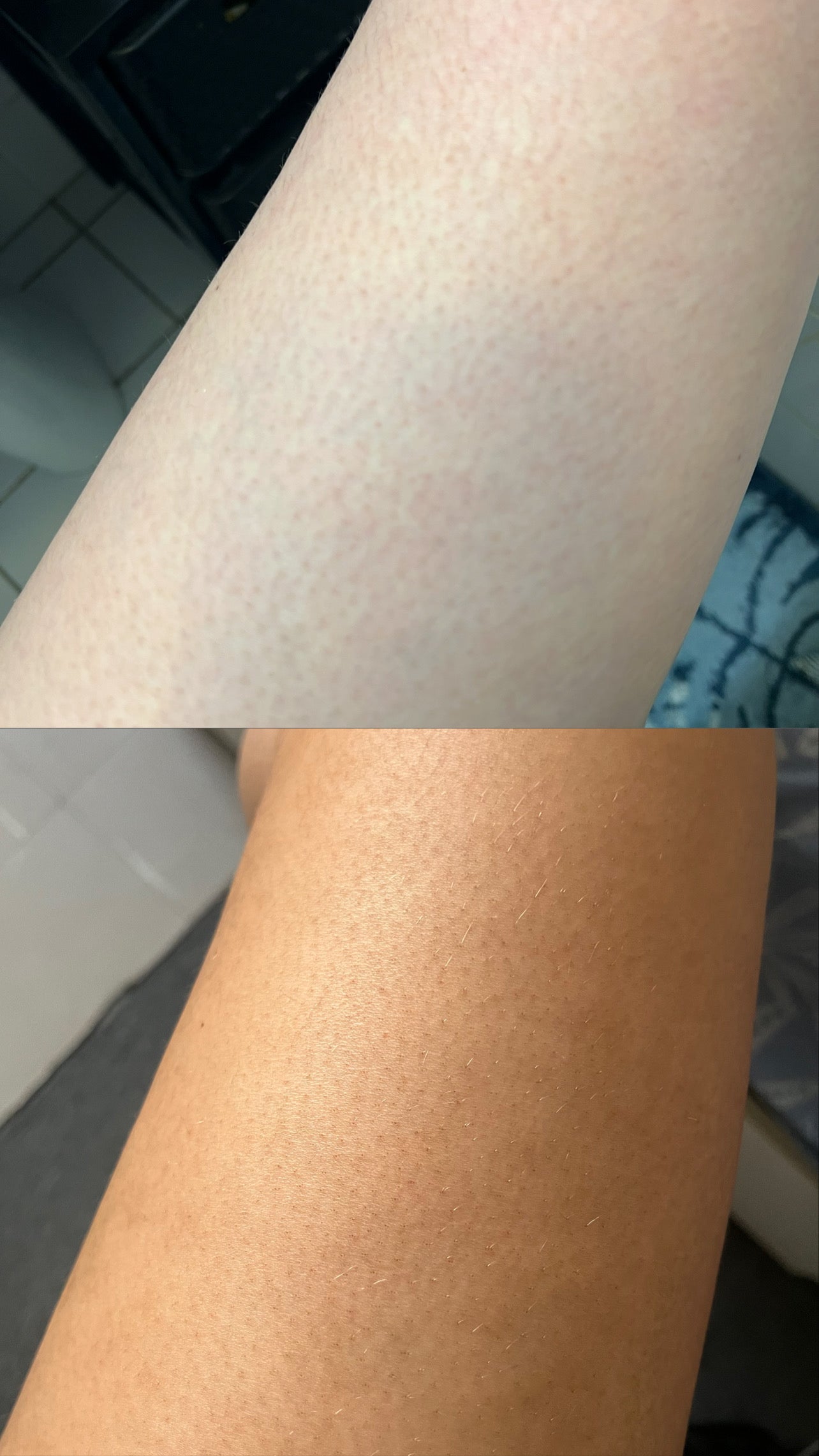 Autobronzant extra dark 200ml